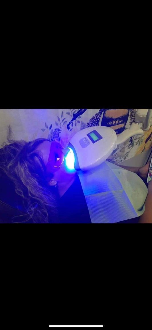 L.E.D Teeth Whitening Service - The Bee Boutiques